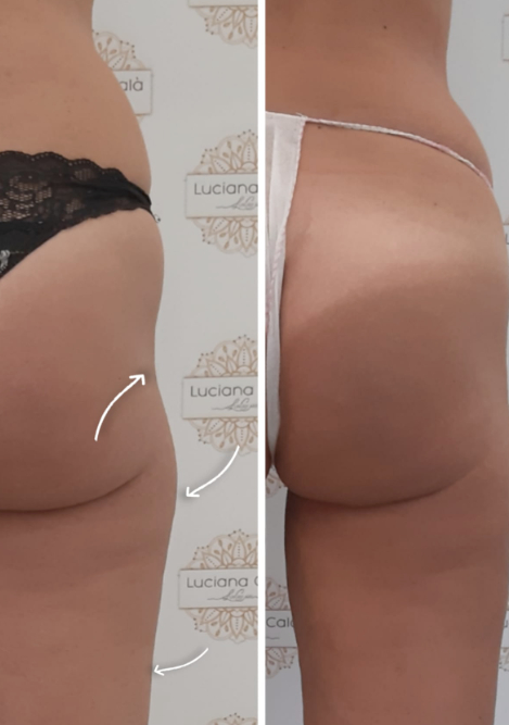 Inserzioni bloccate per violazione Policy